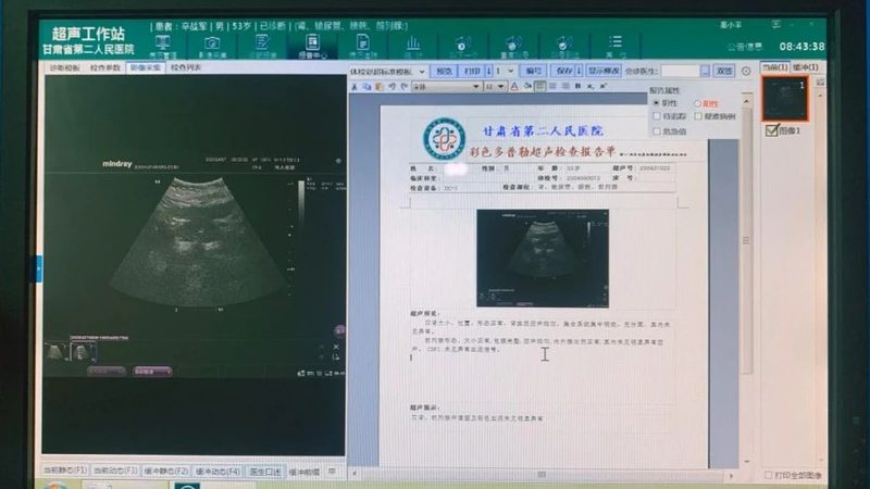 单位体检加盟合同范本：关键条款解读与注意事项**